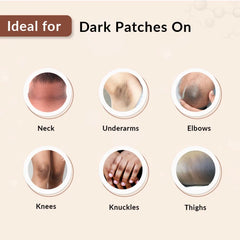 Fixderma Nigrilite Cream, 100gm