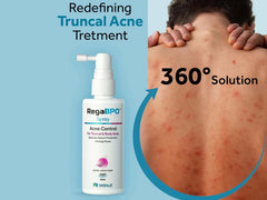Rega-BPO Acne Control Body Spray, 60 ml