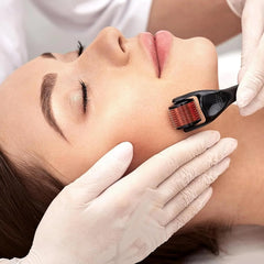 Derma Roller System 540 Needles [0.50mm]