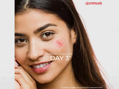 D Acne Soft Face Wash, 100gm